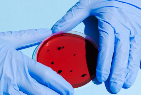 person-holding-petri-dish-3786217