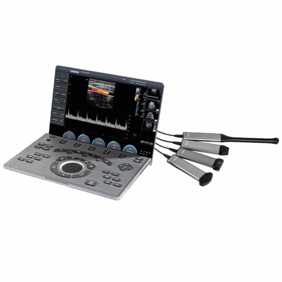 SonoAir