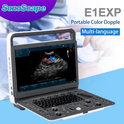 Sonoscape-E1-Exp-Echograph-Echo-Machine-Portable-Color-Doppler-Ultrasound-Machine-for-Hospital