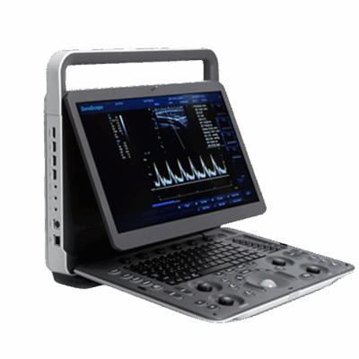 E1 - Sonoscape