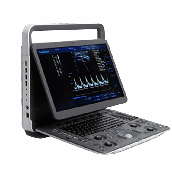 E1 - Sonoscape