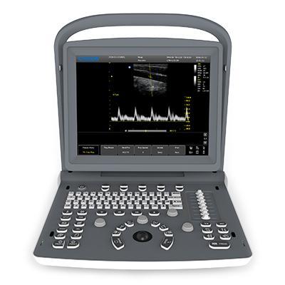 chison_eco2_portable_ultrasound_system_2